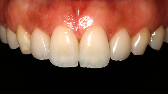 Estética dental y naturalidad